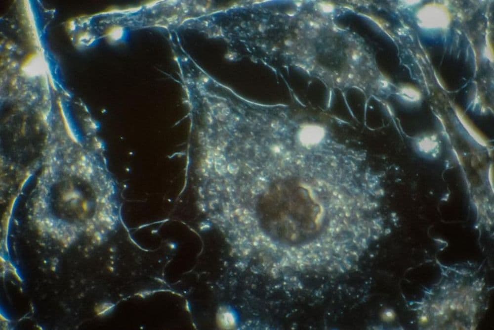 Deep Thoughts: The Link between Oral Health and Dementia