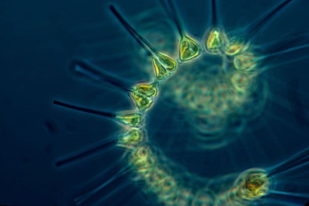 The Microbiome Makeover: Conditioning Your Gut for a Healthier You